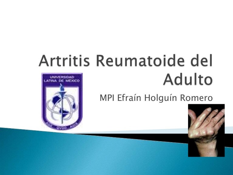 Ancianos en tratamiento reumatoide artritis